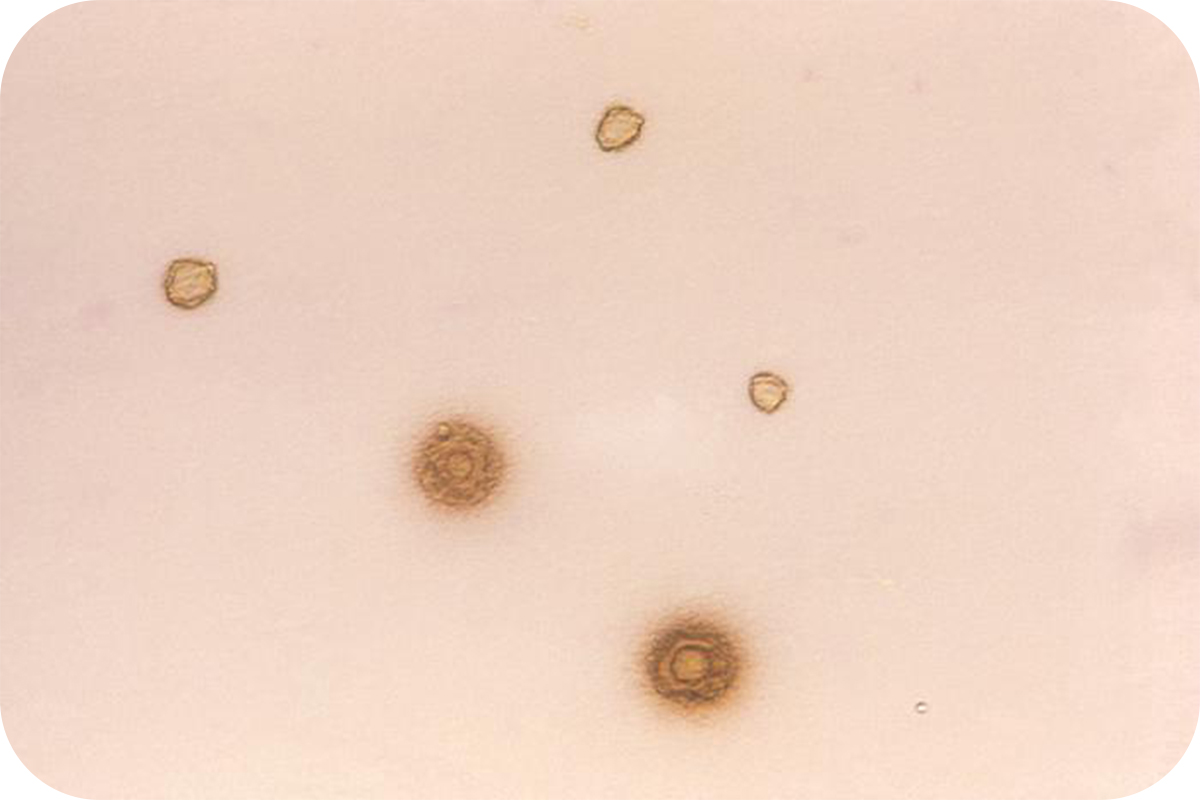 マイコ・ウレアプラズマ