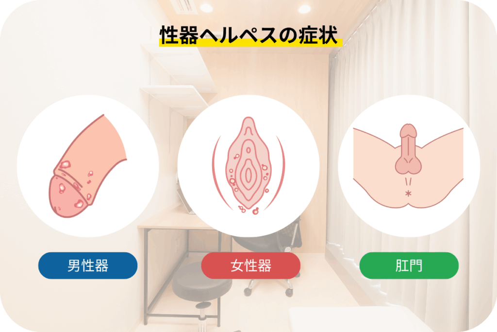 性器ヘルペスの症状について