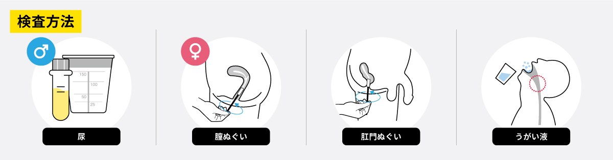 淋菌の検査方法