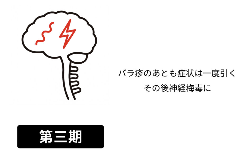 梅毒の症状3期