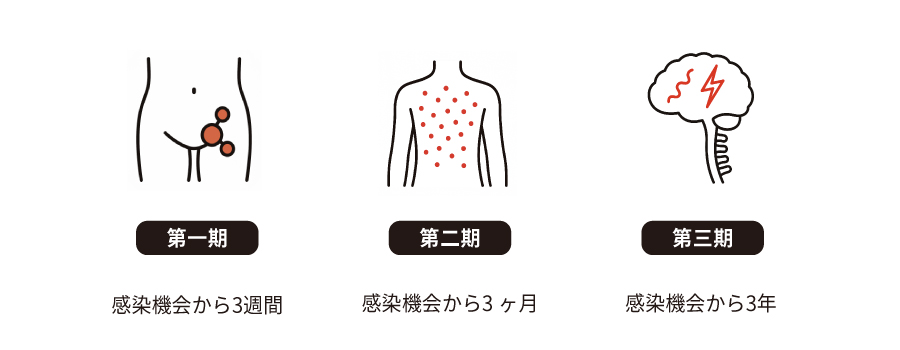 梅毒の潜伏期間について