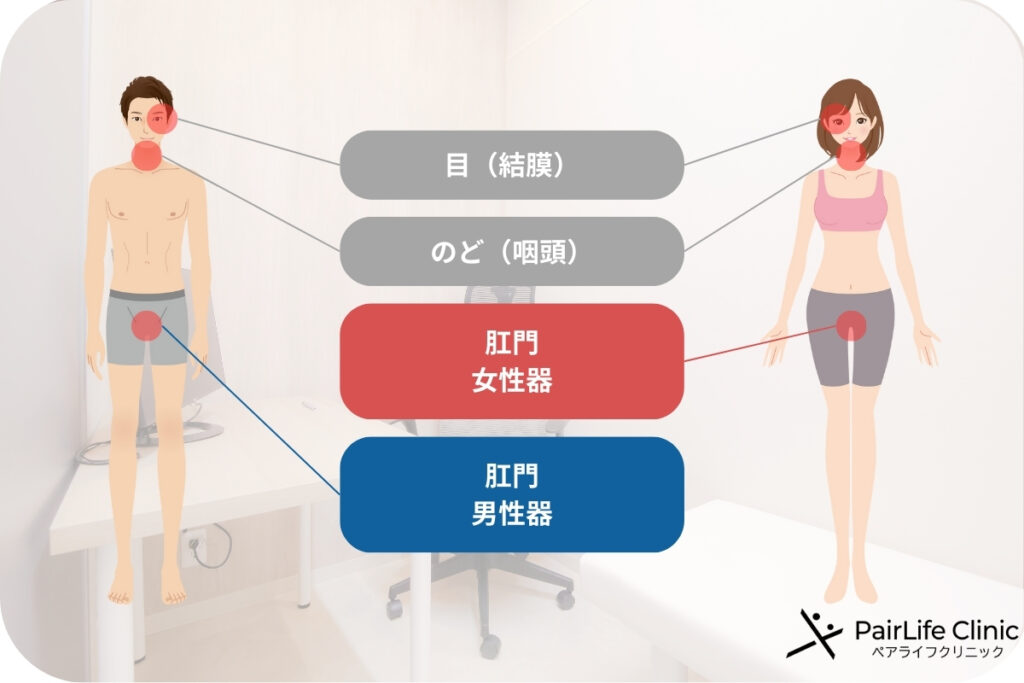 咽頭クラミジアの感染部位
目、喉、肛門、女性器、肛門、男性器