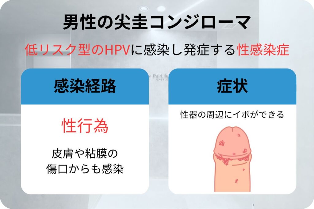 男性の尖圭コンジローマ