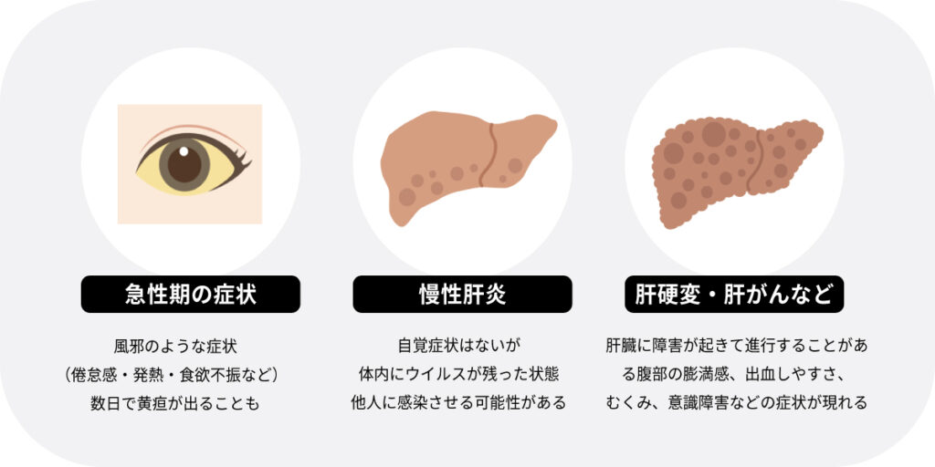 B型肝炎の症状