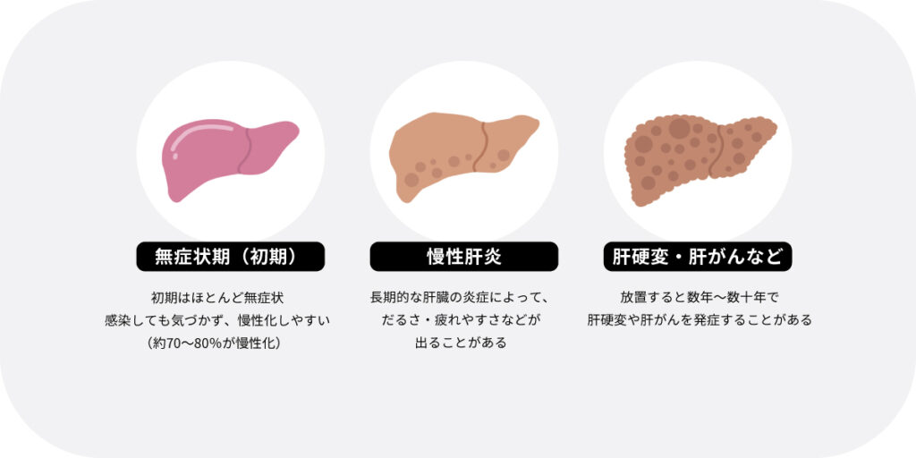 C型肝炎の症状