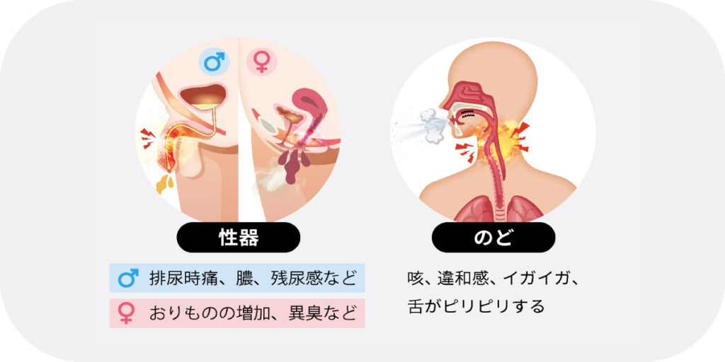マイコプラズマの症状
