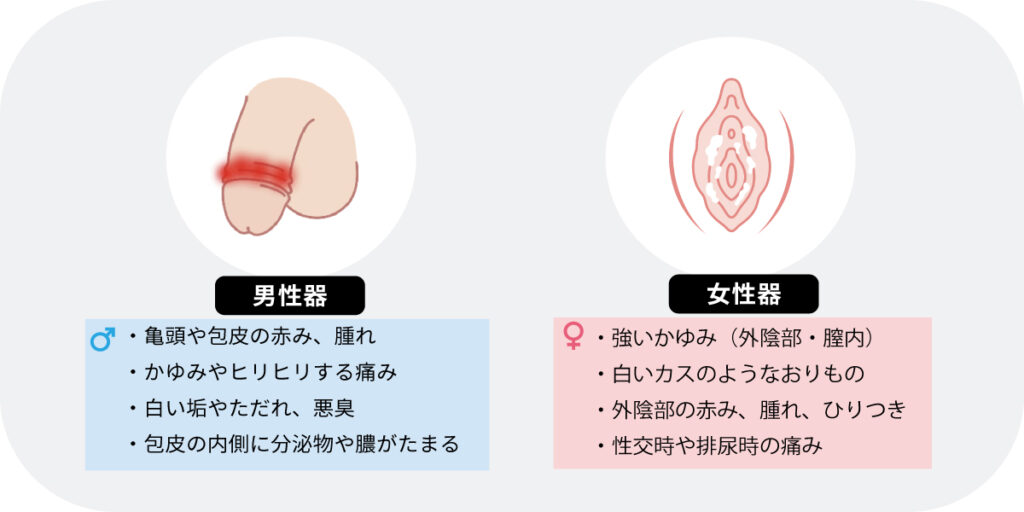 カンジダの症状