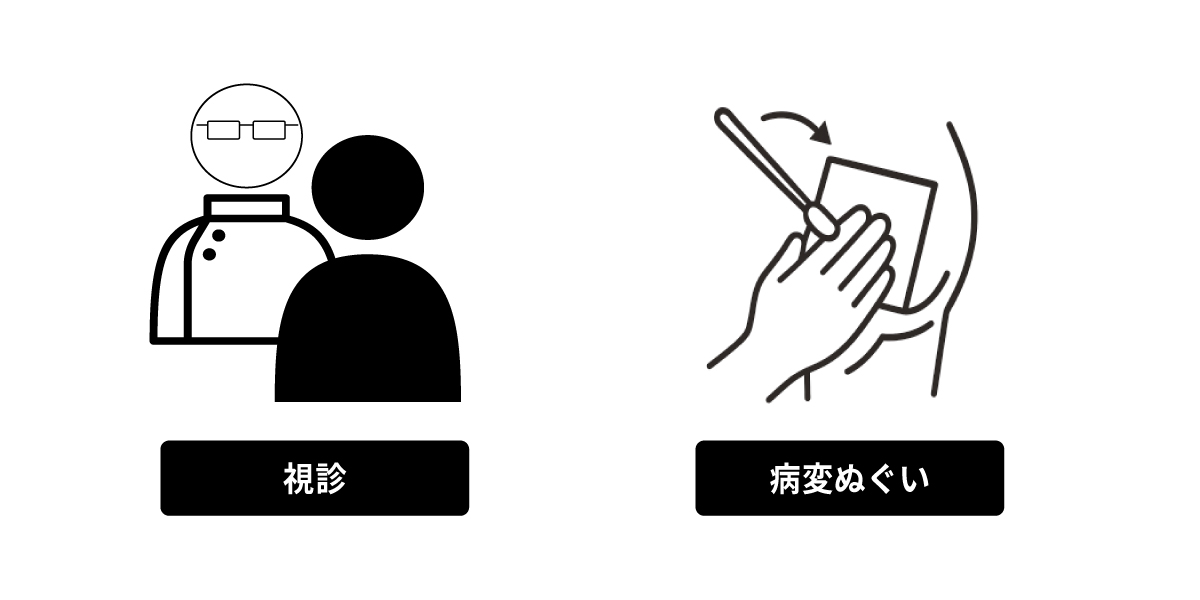 性器ヘルペスの検査方法