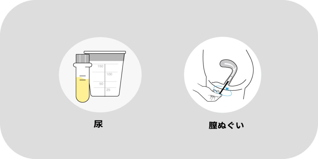 トリコモナスの検査方法