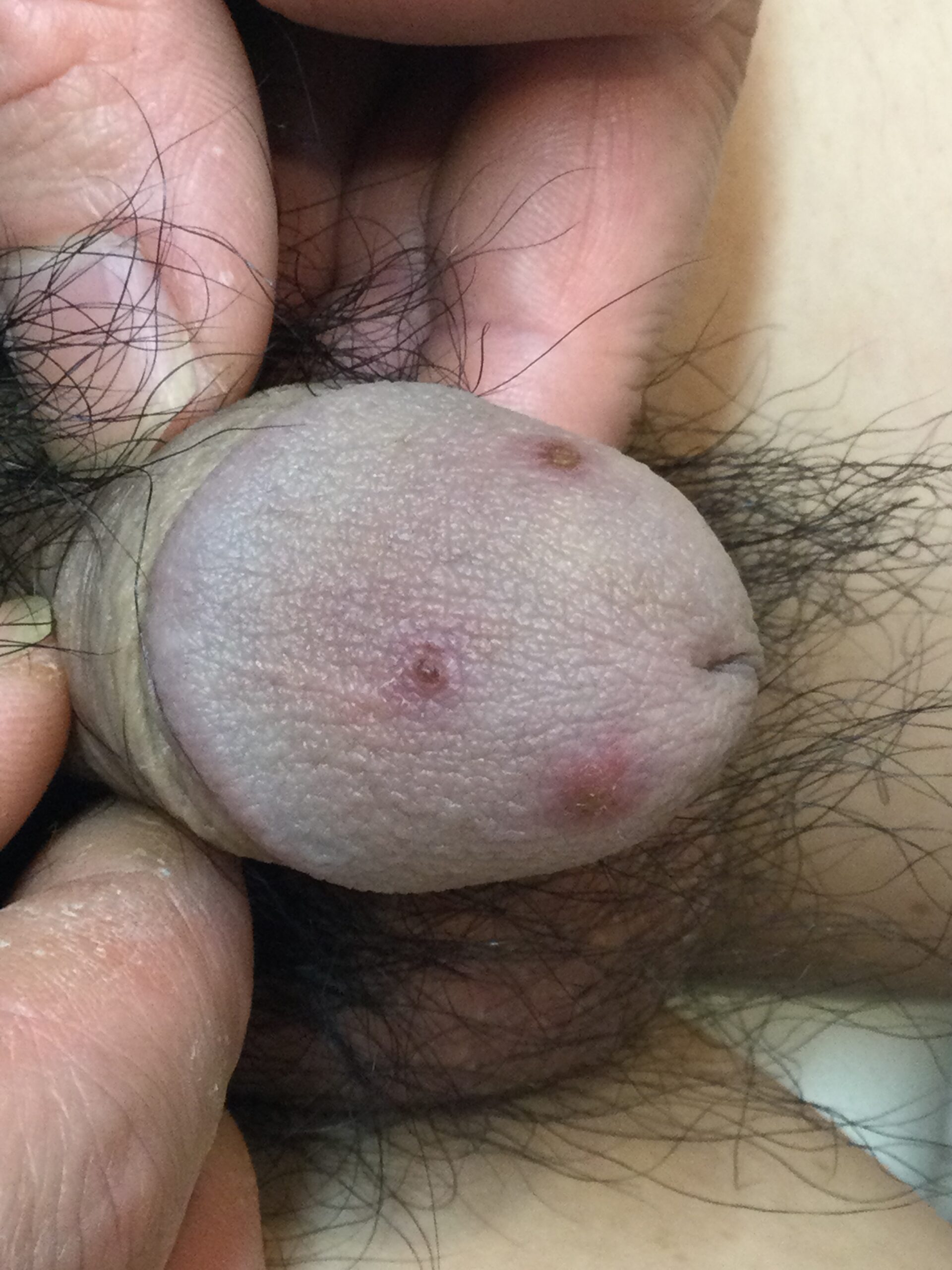 症例画像 1