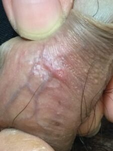 症例サムネイル 2