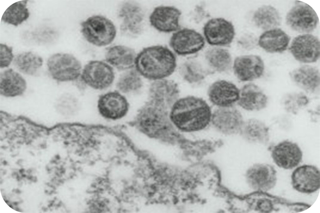 HIV ウイルス