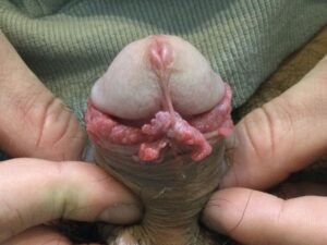 症例サムネイル 3