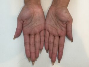 症例サムネイル 1