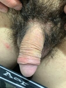 症例サムネイル 1