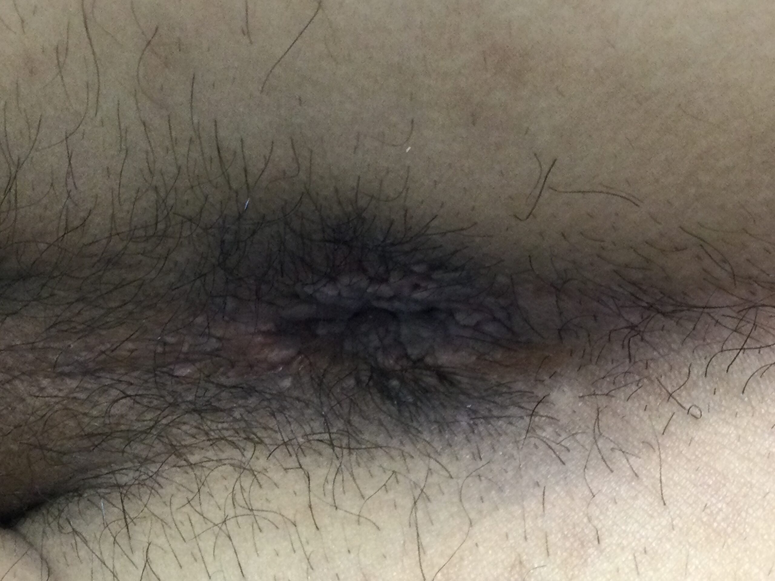 症例画像 1