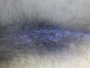 症例サムネイル 2