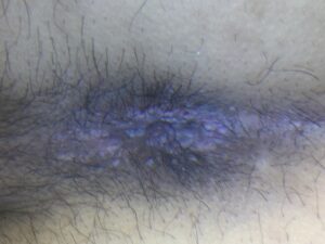 症例サムネイル 3